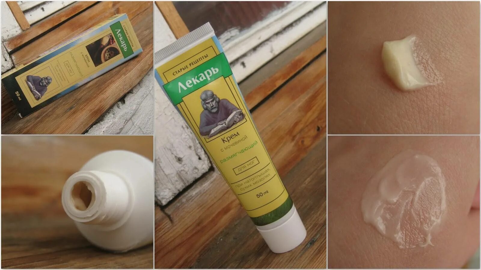 Консервативная терапия анальных трещин. Народные средства от трещин на пятках. Консервативное лечение анальной трещины. Эпидермолитическая кератодермия. Препараты от трещин на пятках.