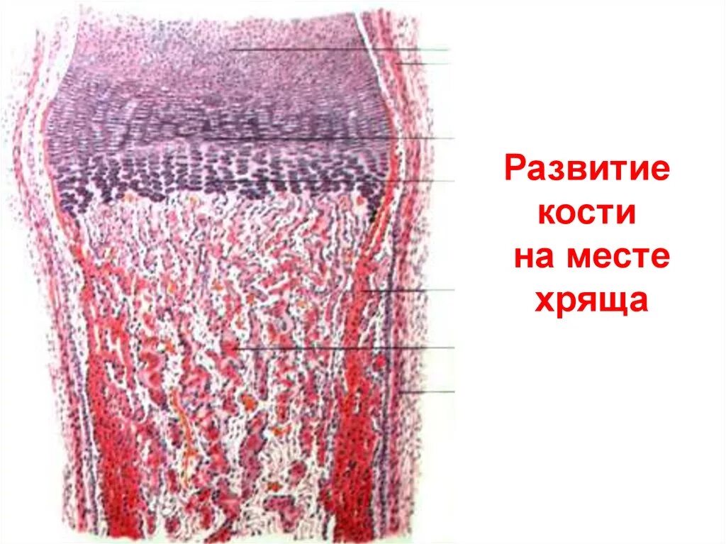 Развитие хряща гистология. Непрямой остеогенез препарат. развитие кости на месте хряща непрямой остеогенез. непрямой остеогенез гистология препарат. развитие костной ткани на месте хряща.