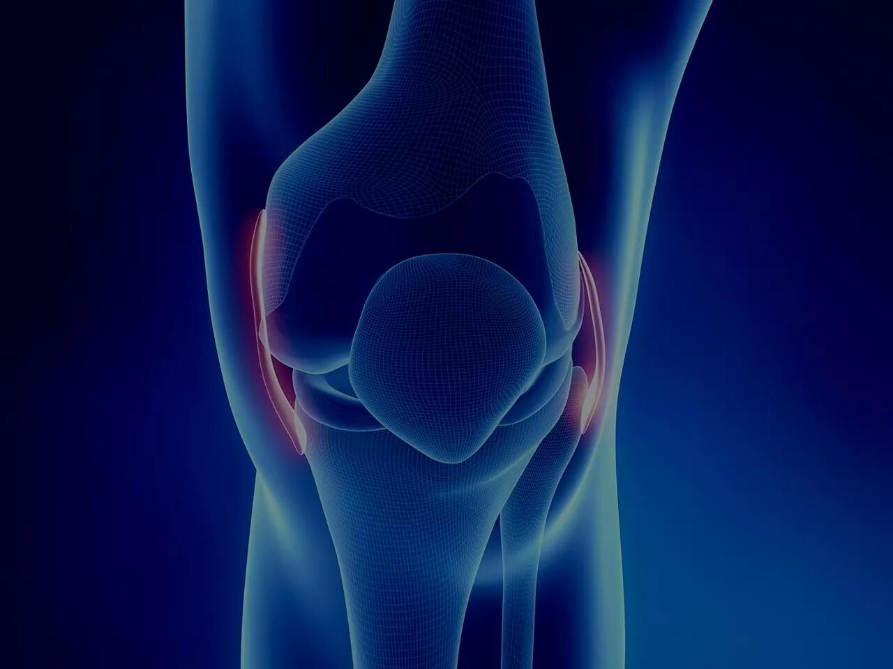 Коленный сустав анатомия человека связки сбоку. Синовит колена коленного сустава. Строение сустава синовиальная сумка. Как устроен коленный сустав человека. Внутри сустав.