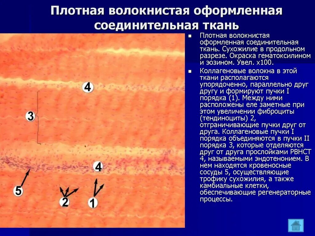 Плотная оформленная ткань. Плотная оформленная эластическая соединительная ткань. Плотная оформленная и неоформленная соединительная ткань. Плотная оформленная эластическая соединительная ткань функции. Плотная оформленная соединительная ткань перитеноний.