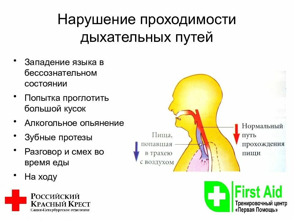 Попала крошка в дыхательные