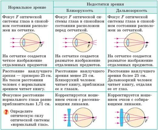 Недостатки дальнозоркости. Недостатки оптической системы глаза. Аномалии рефракции глаза близорукость дальнозоркость таблица. Глаз как оптическая система дефекты зрения физика. Недостатки оптической системы глаза и их коррекция физика.