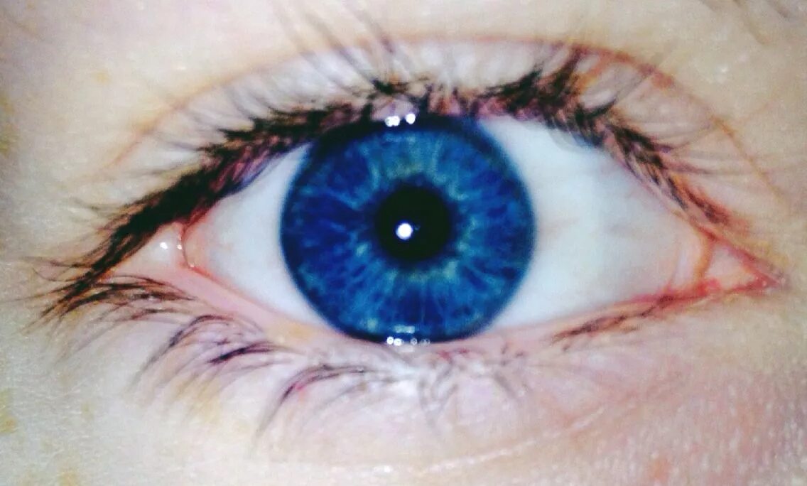 Deep eye