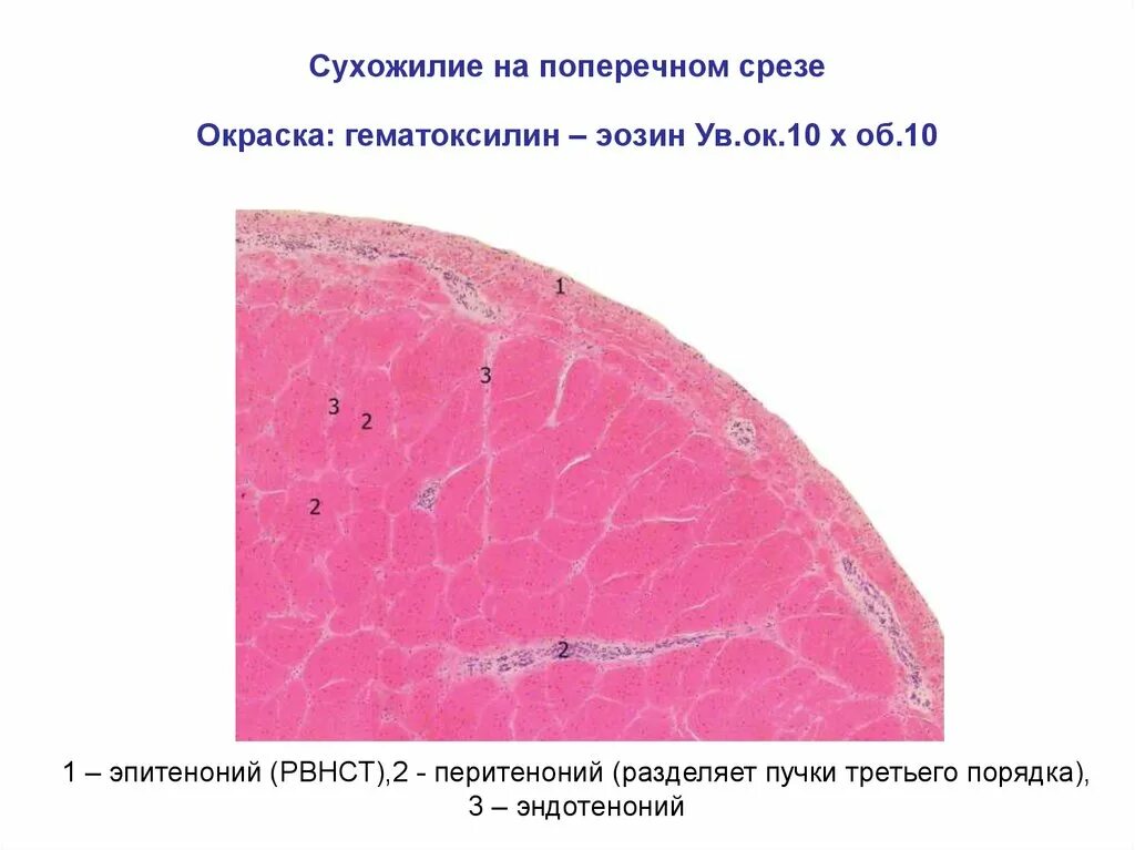 Плотная волокнистая соединительная ткань поперечный срез. Плотная оформленная соединительная ткань сухожилия теленка. Плотная оформленная соединительная ткань препарат поперечный срез. Плотная оформленная соединительная ткань поперечный срез сухожилия.