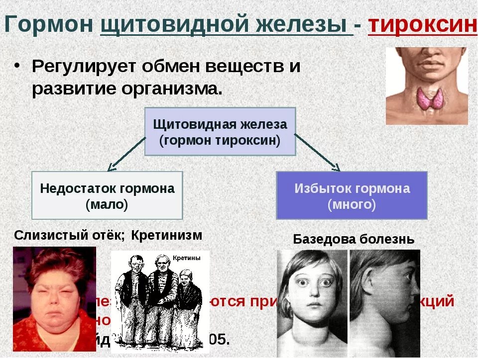 Заболевания связанные с нарушением функций щитовидной железы. При недостатке тиреотропного гормона возникает. Заболевание возникающее при недостатке гормона тироксин. Избыток гормона тироксина. Избыток гормонов щитовидной железы.