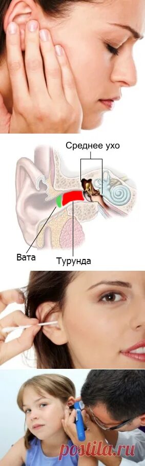Сколько держать турунду в ухе. Как сделать турунду в ухо.