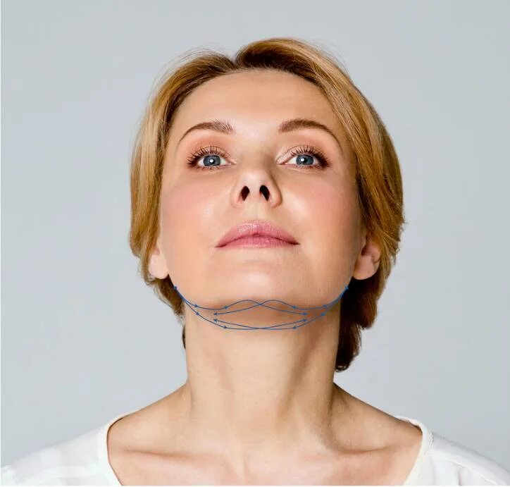 Фото подтяжки шеи. Аптос light lift needle 2g. нити аптос для подтяжки подбородка. aptos needle 2 g. подтяжка нитями аптос второго подбородка.
