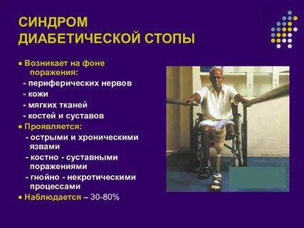 Синдром стопы