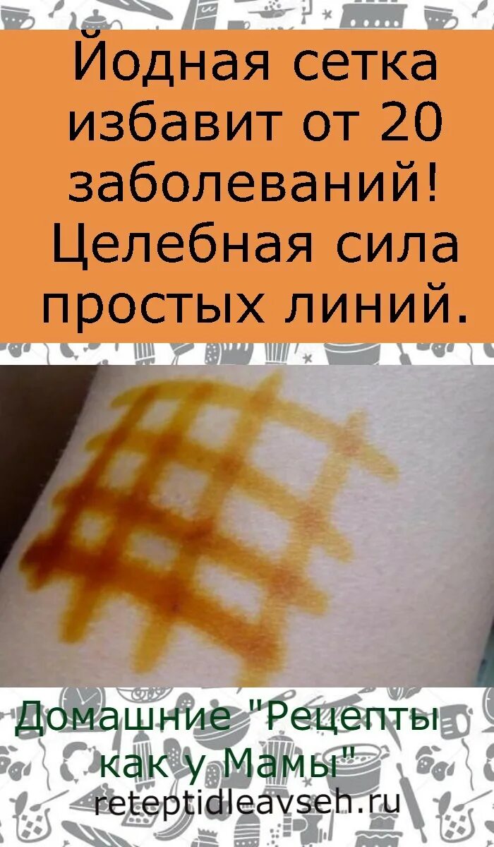 Можно делать йодовую сетку ребенку