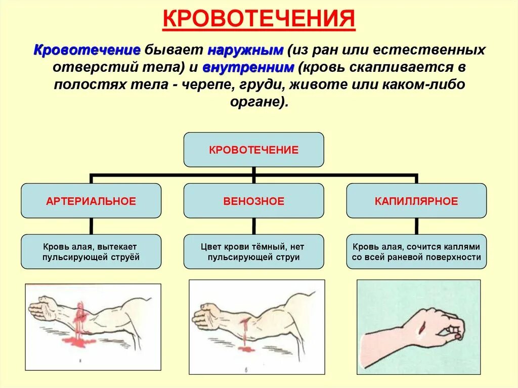 Кровотечения делятся на