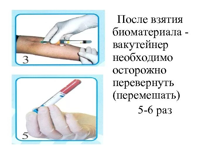 Алгоритм вакуумного забора крови из вены. Система вакутейнер для взятия крови алгоритм действий. Взятие крови из вены вакутейнером. Взятие крови из вены вакуумной системой забора крови. Алгоритм взятия вакуумной системой