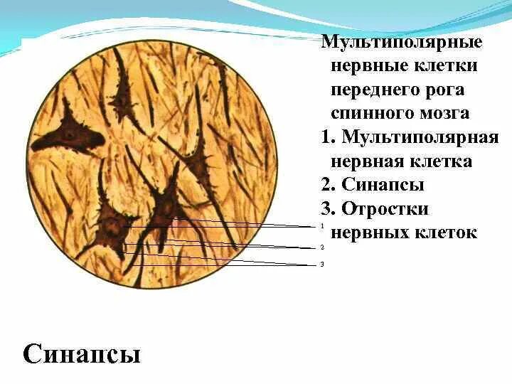 Мультиполярные Нейроны спинного мозга препарат. Мультиполярные нервные клетки спинного мозга препарат. Мультиполярные нервные клетки спинного мозга препарат гистология. Мультиполярная нервная клетка препарат.