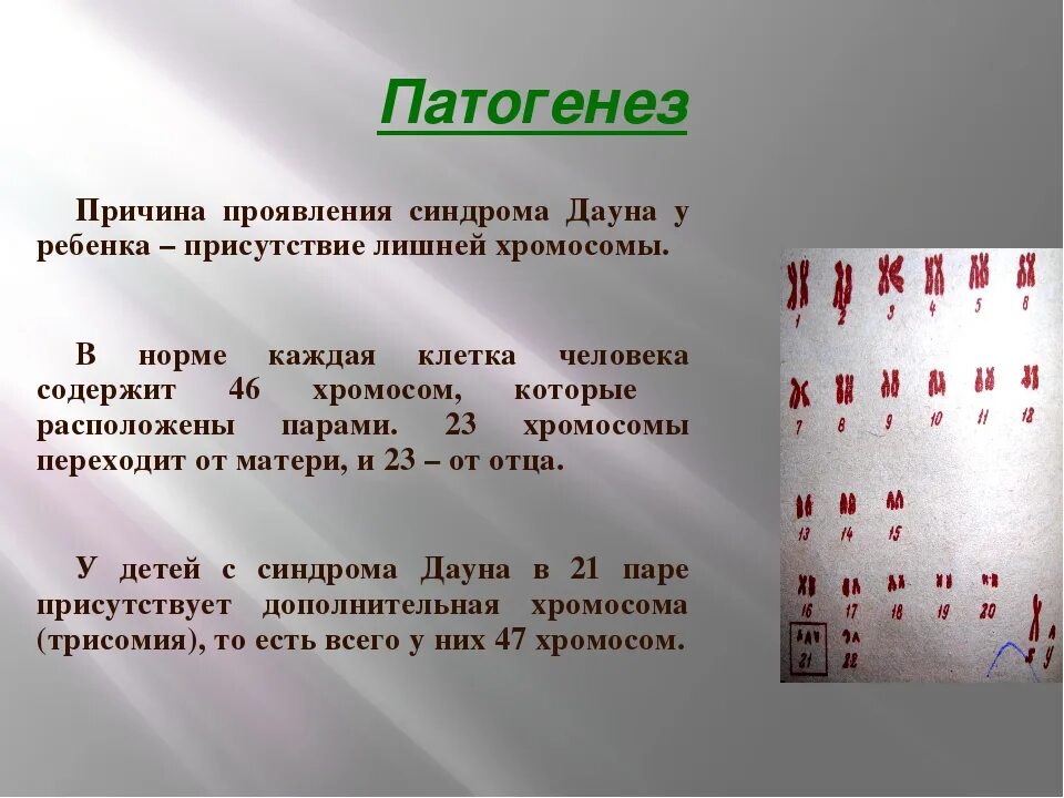Причиной синдрома дауна являются. Синдром дауна причины. Болезнь дауна этиология. Этиология и патогенез синдрома дауна. Причиной синдрома дауна являются.