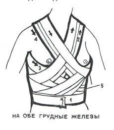 Повязки молочные