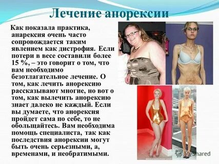 Лечение анорексии