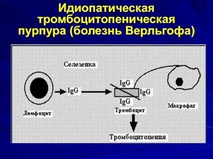 Идиопатический пурпур