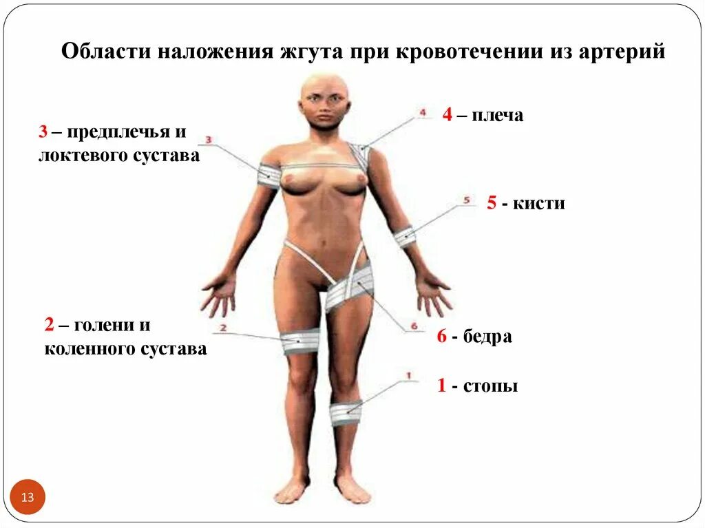 Места наложения жгута при артериальном кровотечении. Области наложения жгута при кровотечении из артерий. Куда нельзя накладывать жгут при артериальном кровотечении.