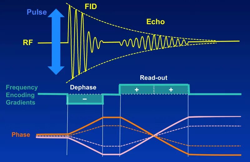 Быстро эхо. Градиент Эхо. Фотонное Эхо. Последовательность градиентного Эха. Турбо спин Эхо мрт.
