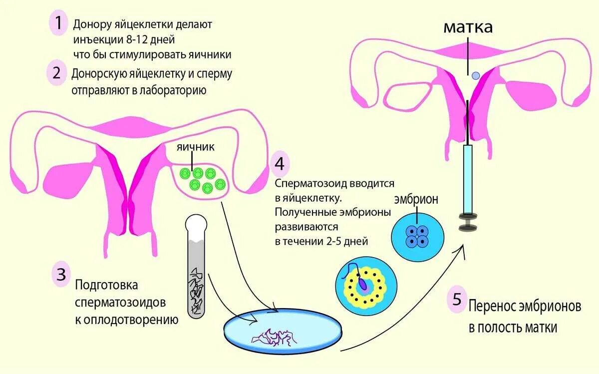 Продать яйцеклетку
