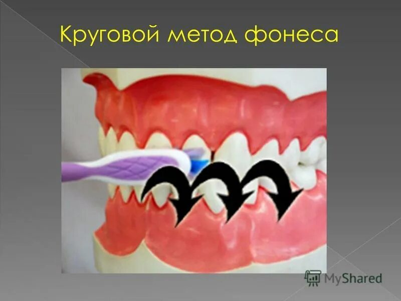 Метод басса чистка. Метод Фонеса чистки зубов. Круговой метод чистки зубов. Круговой метод чистки зубов fones.