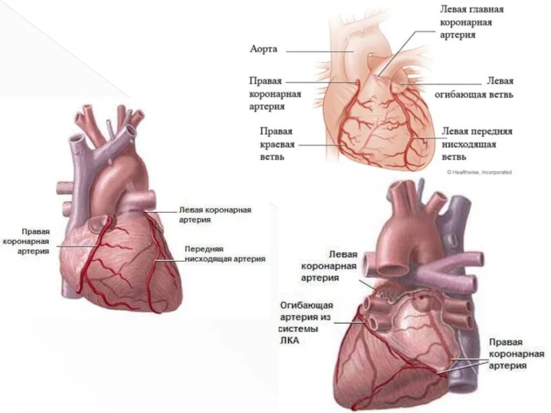 Левая передняя нисходящая коронарная артерия. Ветви огибающей коронарной артерии. Коронарная артерия левой передней нисходящей ветви. Передняя межжелудочковая ветвь левой коронарной артерии.
