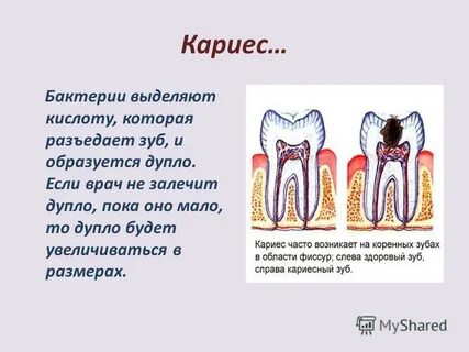 Бактерии кариеса