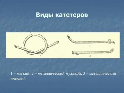 Катетеризация металлическим катетером