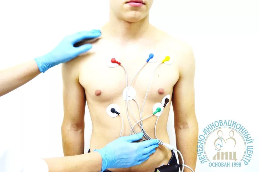 Эрг хелтеровское монитированиe. Куда ставят холтер. Холтер экг наложение электродов. Эрг хелтеровское монитированиe. Куда ставят холтер.