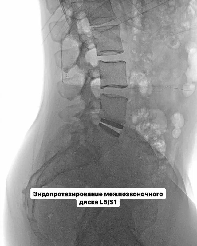 Матулевич врач ростов. Вертебролог матулевич. Врач хирург травматолог-ортопед. Мануальная терапия в вертеброневрологии. Вертеброневролог в пензе.