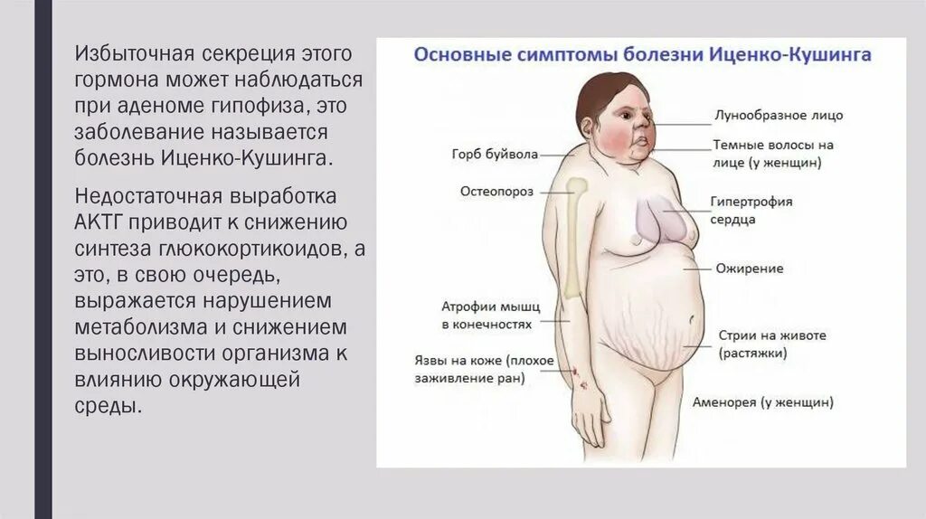 Синдром кушинга рекомендации. Болезнь иценко кушинга терапия. синдромы рейфенштейна, иценко-кушинга.. синдром и болезнь иценко-кушинга отличия.