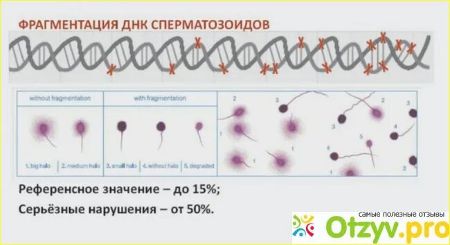 Фрагментация днк методы. Спермограмма с ДНК фрагментацией. Оценка фрагментации ДНК спермограммы норма. Повреждение ДНК спермограммы. Расшифровка фрагментации ДНК спермограммы.