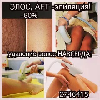 Как избавиться от волос на руках навсегда