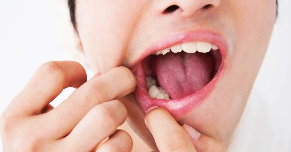 зуб со стороны языка