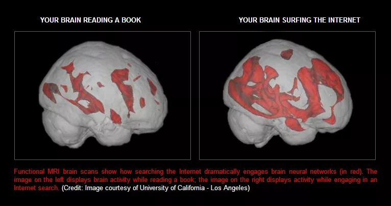 Reading in the brain. Brain activity. brain activity бад. brainscan.