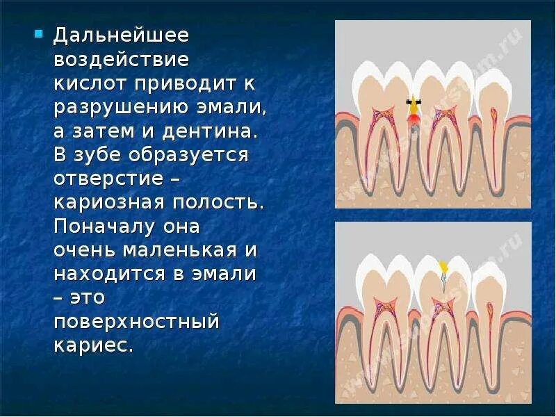Дентин зуба образуется из. Дентин зуба образуется из