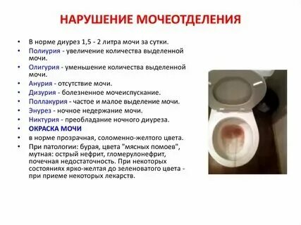 Никтурия при сердечной недостаточности. Причины ночных мочеиспусканий. Никтурия у мужчин что это. Ночная поллакиурия. Никтурия у мужчин что это.