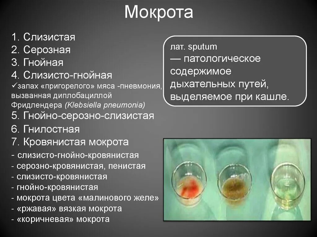 Темная слюна. Гнойно слизистая мокрота. Цвет мокроты и заболевания.