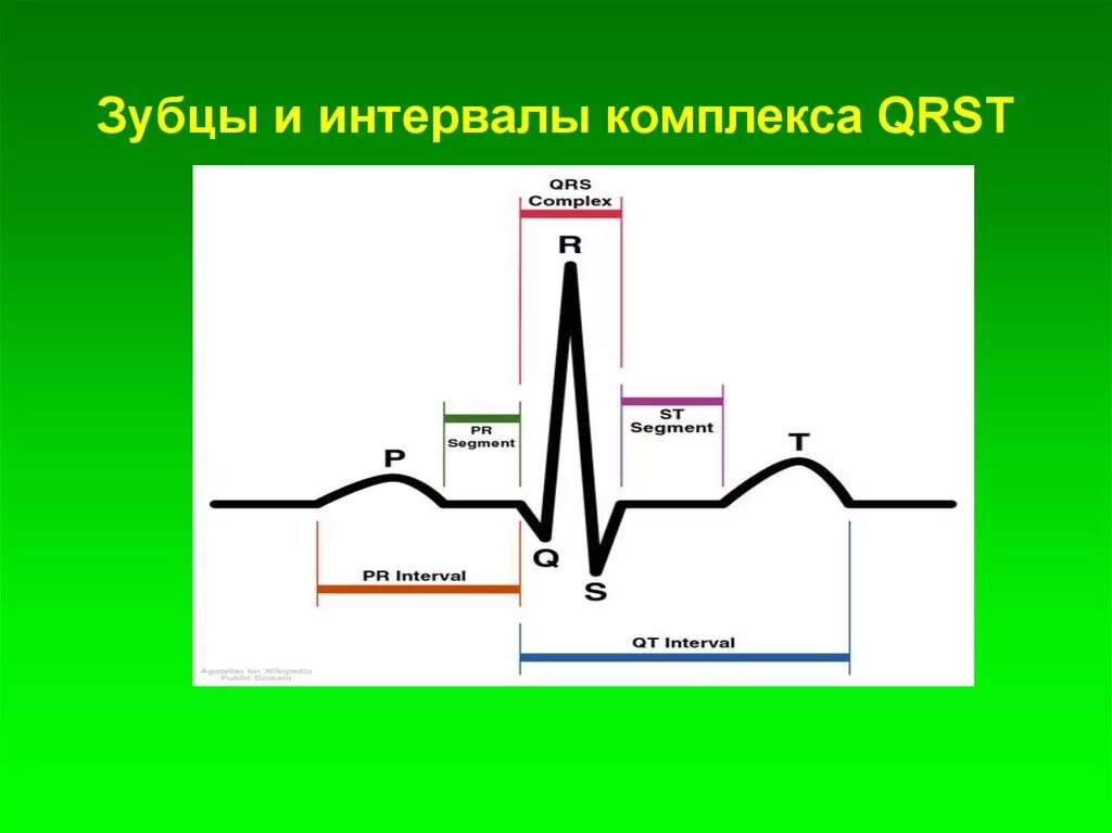 Рисунок интервала. Комплекс зубцов QRS на ЭКГ. Длительность комплекса QRS В норме. Интервал QRST на ЭКГ. Желудочковый комплекс QRST.