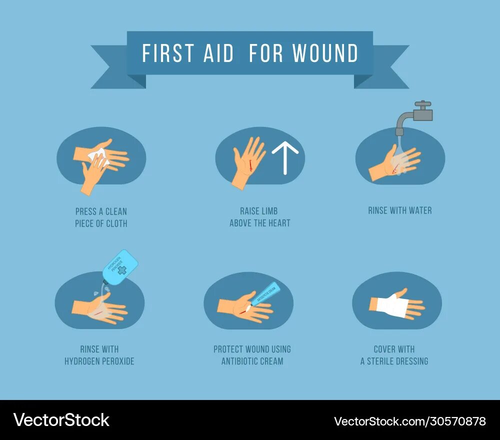 First aid bleeding. First aid bleeding