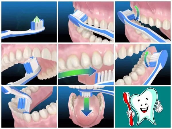 Техника чистки зубов. Правильная чистка зубов. Правильно чистить зубы. Схема чистки зубов.