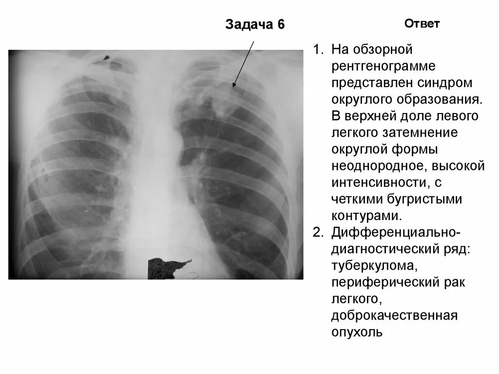 Неоднородное округлое образование