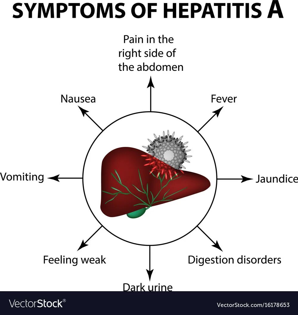 Гепатит hb. Hbv гепатит. гепатит на английском языке.