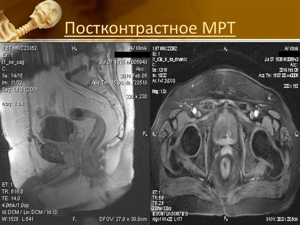 Dicomdir чем открыть снимки мрт. Интересные случаи на мрт. реферат на тему мрт. мрт online. презентация мрт д-ра верзаковой ольги.