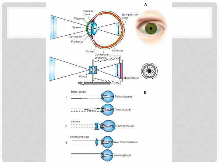 Тест 24 органы чувств зрительный анализатор. Анализатор зрения. Анализаторы человека зрение. Анализаторызрительны оптическая система. Анализаторызрительны близорукость.