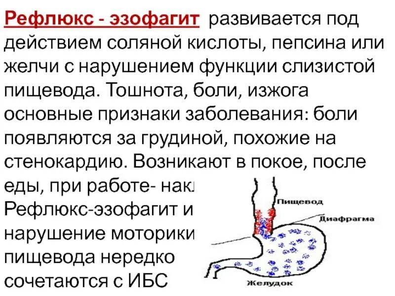 Желудочно-пищеводный рефлюкс осложнения. Симптомы эзофагита пищевода. Рефлюкс-эзофагит симптомы. Боль в желудке при глотании