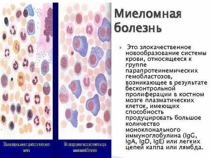 Анемия при злокачественных новообразованиях