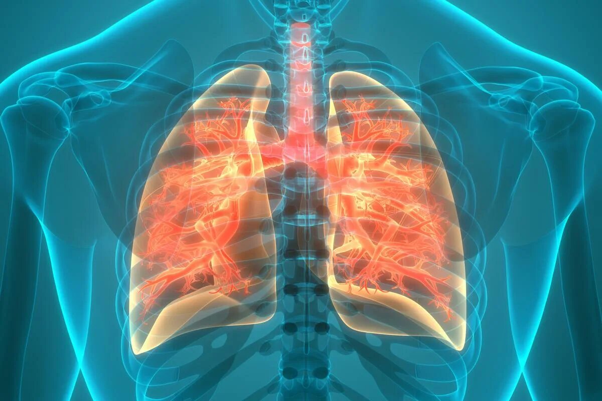 Lung disease. Заболевания органов дыхания. Lung disease. Childhood interstitial lung disease. Lung disease.