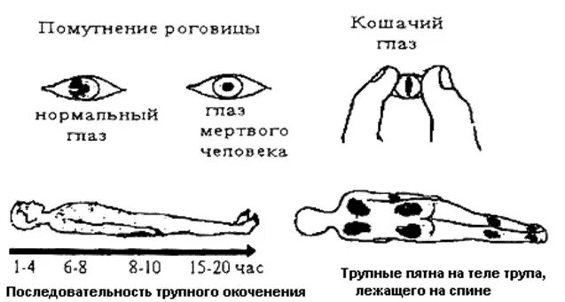 Убитый глаза не могу открыть на ощупь