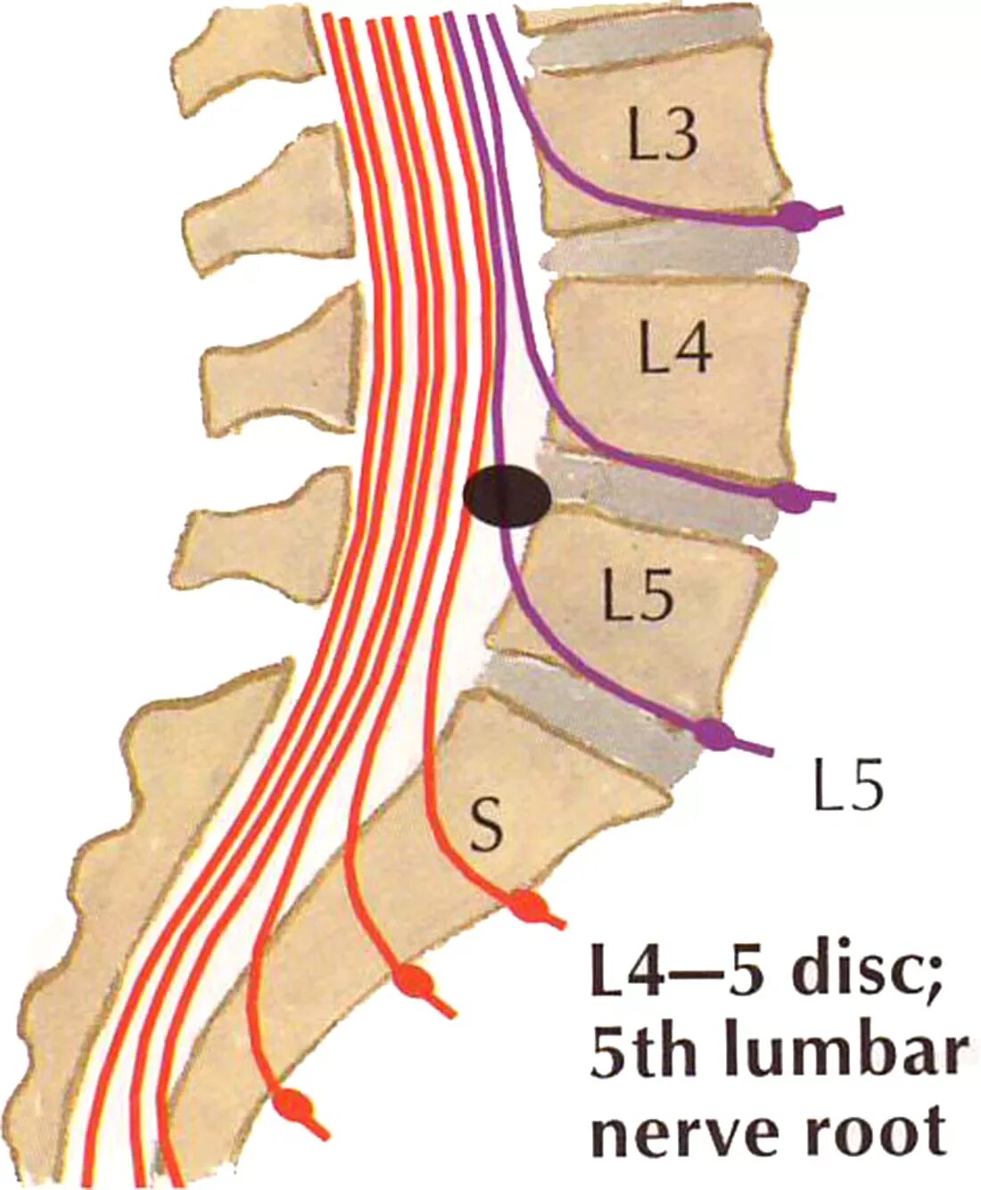 Позвоночник отделы l5 s1. Межпозвонковые диски l1-l2. Диски позвонков l3-l4, l4-l5, l5-s1. Протрузия l1-l4. Позвоночные диски l5-s1.