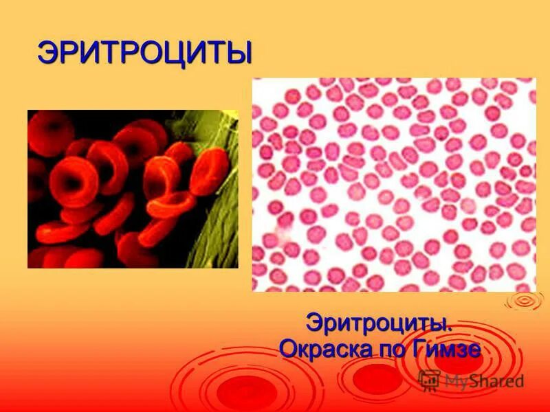 Эритроциты окрашиваемые. Эритроциты биология 8 класс. окраска эритроцитов. изменение окраски эритроцитов. эритроциты окрашены.